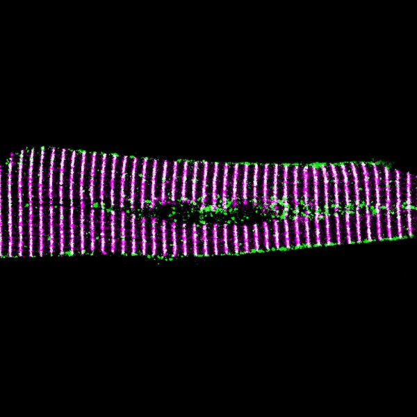 Confocal microscope image of zebrafish skeletal muscle labeled with DSHB antibody 34C (magenta). PMID: 35293586, Fig. 2E.